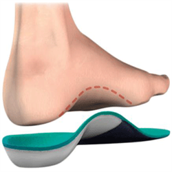 Off the Shelf Orthotics